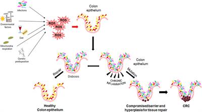 Colorectal cancer and therapy response: a focus on the main mechanisms involved